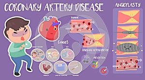 Coronary artery disease infographic