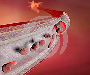 Coronary artery