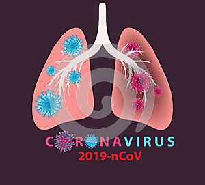 Coronavirus banner for awareness & alert against disease spread, symptoms or precautions. Corona virus design with infected lungs