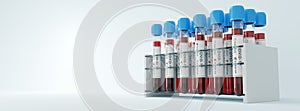 Coronavirus Covid19 test tubes in a rack. Medical screening and Covid tests production