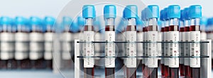 Coronavirus Covid19 test tubes in a rack. Medical screening and Covid tests production