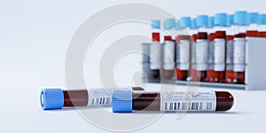 Coronavirus Covid19 test tubes in a rack. Medical screening and Covid tests production 3d render