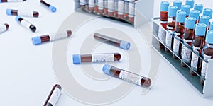 Coronavirus Covid19 test tubes in a rack. Medical screening and Covid tests production 3d render
