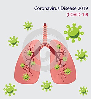 Coronavirus disease COVID-19 infection medical in human lungs. Virus or bacterial infects lungs. Coronavirus causing pneumonia of