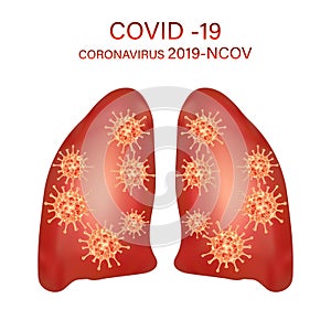 Coronavirus disease COVID-19 infection medical illustration. China pathogen respiratory influenza covid virus cells in lungs