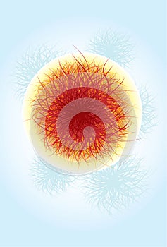 Coronavirus infection (COVID-19)