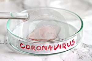 Coronavirus in laboratory and reserch concept photo