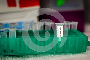 Coronavirus sample stored in freezer for vaccine development and research
