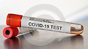 Coronavirus test concept - vial sample tube with cotton swab, another container in background, closeup detail. Sticker is own