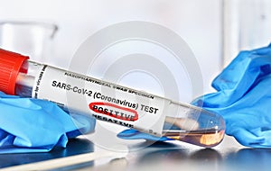 Coronavirus test concept - vial sample tube with cotton swab, word positive circled in red, blurred lab equipment and blue nitrile