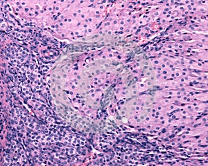 Corpus luteum. Granulosa-lutein and theca-lutein cells