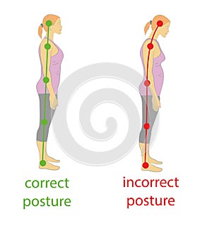 Correct alignment of human body in standing posture for good personality and healthy of spine and bone. Health care and medical il photo