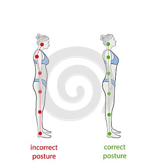 Correct alignment of human body in standing posture for good personality and healthy of spine and bone. Health care and medical il