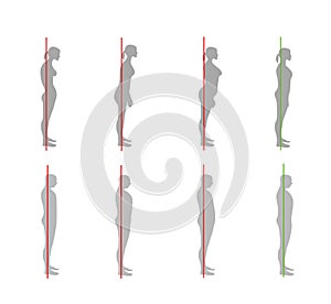 Correct alignment of human body in standing posture for good personality and healthy of spine and bone. Health care and medical il