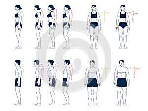 Correct incorrect postures. Good bad posture, wrong body positions. Right corrections person backs. Man woman spine