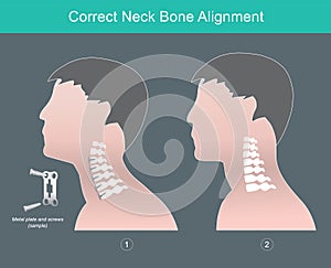 Correct Neck Bone Alignment.