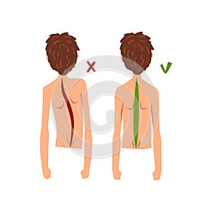 Correct and wrong spine posture, back view vector Illustration on a white background