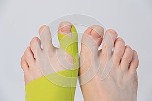 Correction of the big toe. Haliux valgus. Taping with flat feet. Taping when fingers are deformed. Innovative medicine.