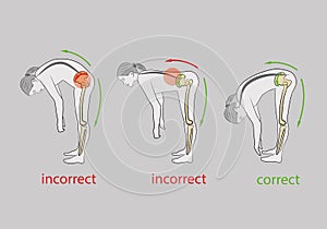 Correctly and incorrectly tilt forward. medical recommendations. backache problems. vector illustration.