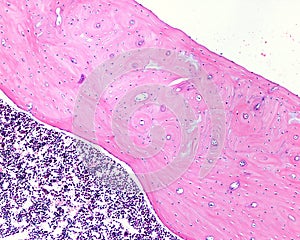 Cortical bone and bone marrow