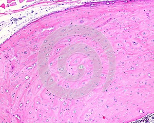 Cortical bone tissue
