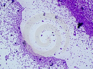 Coryneform Bacterium