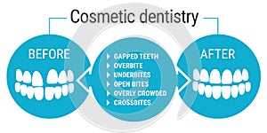 Cosmetic dentistry before after