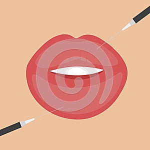 Cosmetic injection in beautiful big lips. Cosmetologist vector illustration. Medical treatment, lip fillers and spa beauty concept