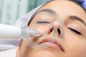 Cosmetic laser pen reducing wrinkles on female face photo