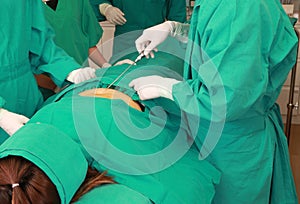Cosmetic liposuction surgery in actual operating room