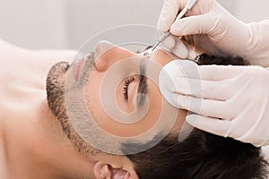 Cosmetician using blackhead remover for cleaning man face photo