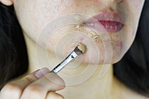 Cosmetics acne, Asian woman applying concealer makeup to hide acne facial skin problem.