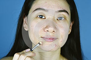 Cosmetics acne, Asian woman applying concealer makeup to hide acne facial skin problem.