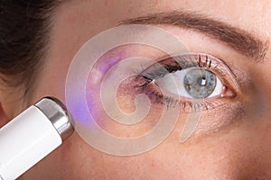Cosmetological procedure laser resurfacing of scars on the skin. Concept of a modern scar removal procedure, close-up.