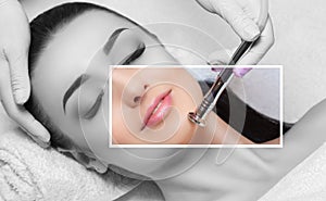 The cosmetologist makes the procedure Microdermabrasion of the facial skin of a beautiful, young woman in a beauty salon.