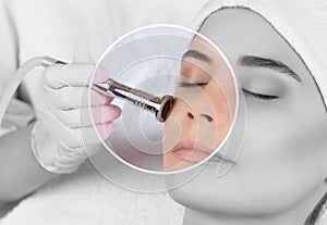 The cosmetologist makes the procedure Microdermabrasion of the facial skin of a beautiful, young woman in a beauty salon.