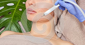 The cosmetologist makes the procedure treatment of Couperose and face cleaning of the skin of a beautiful, young woman in a beauty photo