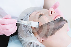 The cosmetologist in pink gloves with a brush applies a carbon mask for peeling on the face of a young girl in a