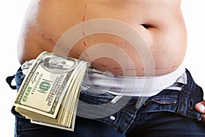 Cost of liposuction photo