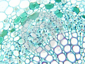 Cotton Leaf 400x magnification Stained