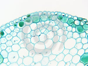 Cotton leaf Top 400x magnification Stained