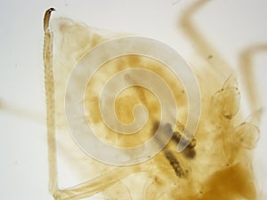 Cotton worm abdomen 100x Magnification