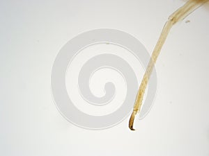 Cotton worm leg 100x Magnification