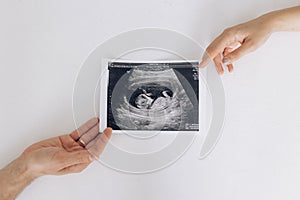 Couple parents holds ultrasound snapshot their future baby in womb