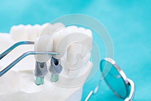 Couse up dental prosthesis and tools.