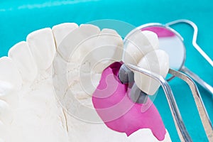 Couse up dental prosthesis and tools.