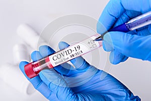 Covid-19 coronavirus disease blood test tube in hands epidemic concept background