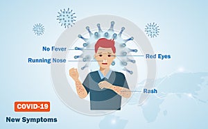 COVID-19 coronavirus new symptoms.  Man suffering from running nose, red eyes and rash with no fever