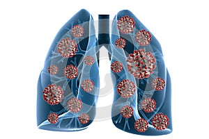 Covid-19. Human lungs Replica by moldy bread. Sars disease, coronaviruses in the lung. The coronavirus causes the severe illness