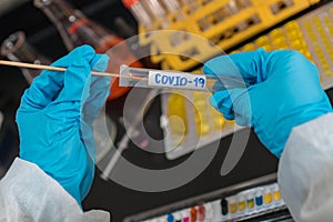 COVID-19 Nasal swab laboratory test in hospital lab